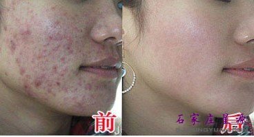 ʯ��ׯ�＾������ò���?