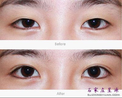 ʯ��ׯ��˫��Ƥ��������ʱ����