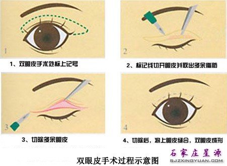 ����Դ ���Լ�һ˫���Ĵ��۾�