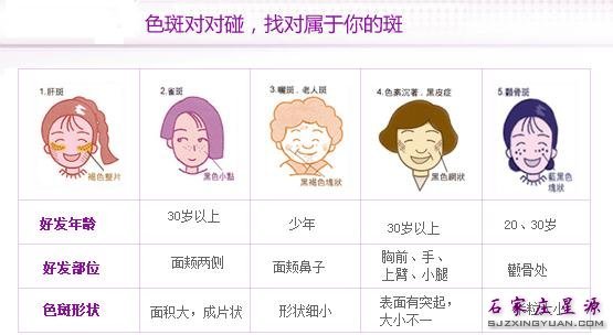 认清面部色斑 选择适合自己的祛斑方法