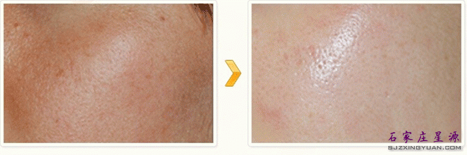 ˮ��ע��Ա�ͼ��һ��