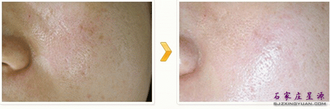 ˮ��ע��Ա�ͼ������