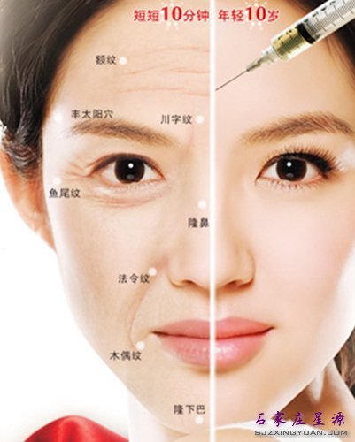 微整项目三:自体脂肪填充