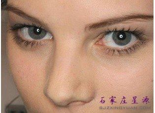 石家庄开眼角能使眼睛变大么