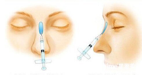 ʯ��ׯע��¡�Ƕ���Ǯ��