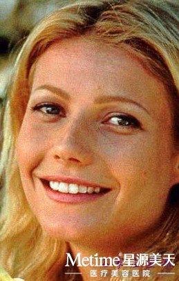 开眼角价格不是固定的