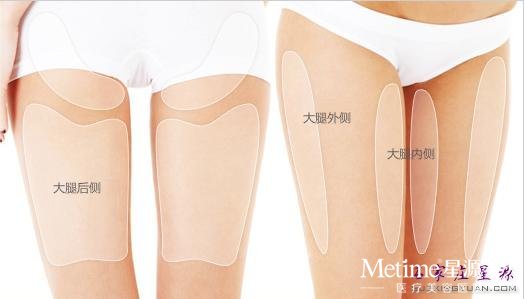 石家庄腿部吸脂手术贵不贵