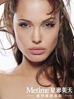 埋线双眼皮的优势无可比拟