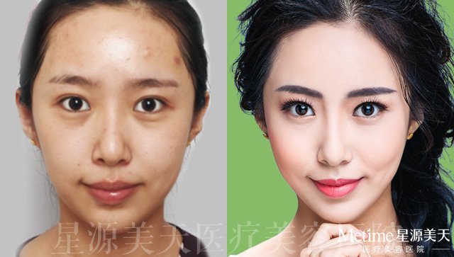 �����ö�ױ������