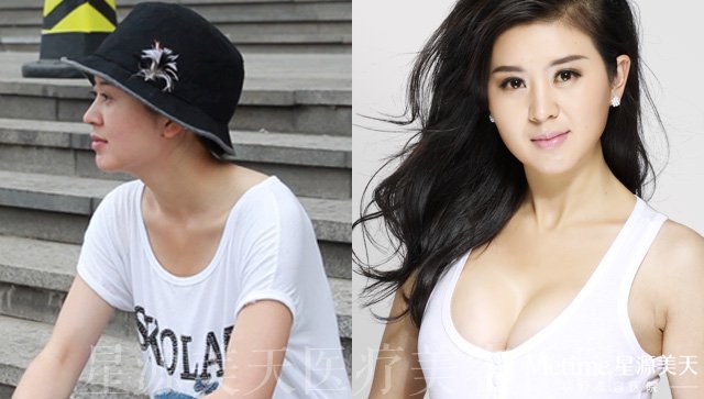 ���������ʵ����