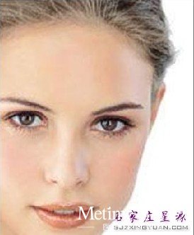 像素激光去痘坑的效果很理想