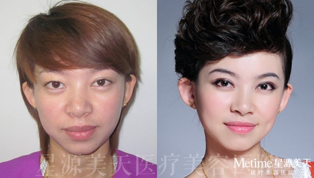 ˫��Ƥ��ʵ����