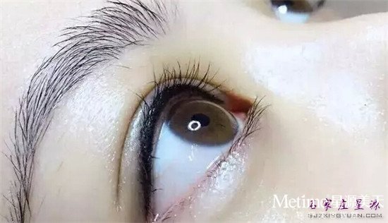 ����ͫ�߼۸�