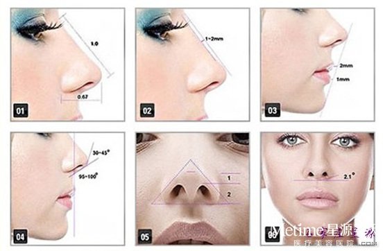 鼻孔缩小术效果不错