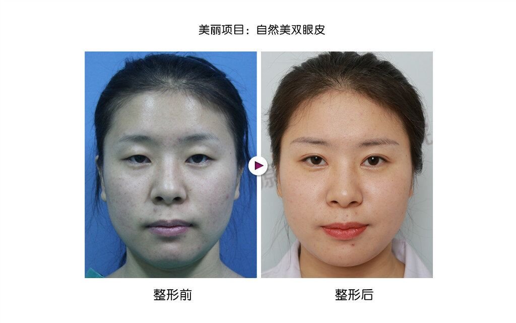 ���������