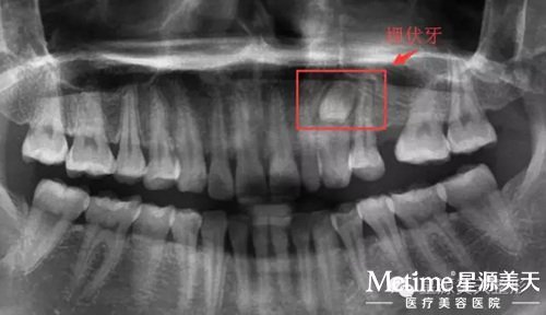 ÿһ�ΰ�������Ҫ��Ƭ�� �����ݵ�λ�����