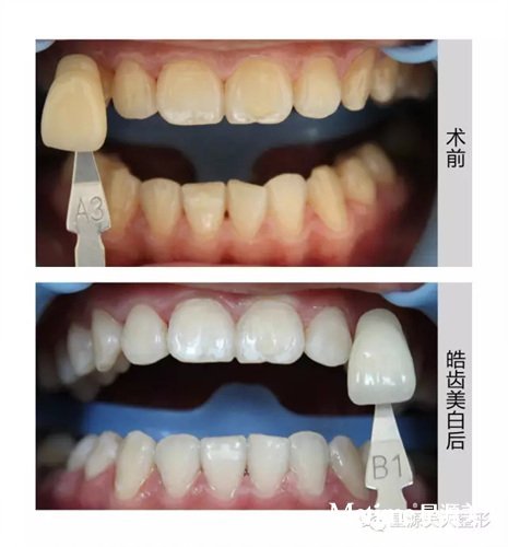 ������ǰ��Ա�