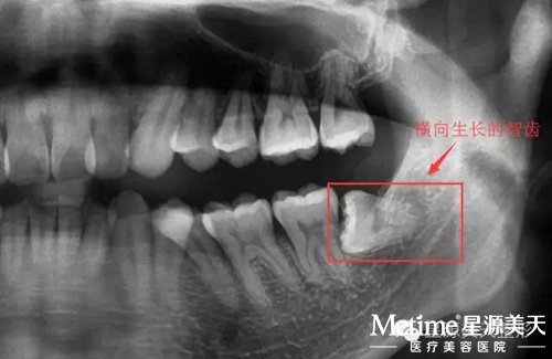 �����������ǳ� һ�����ҽ������