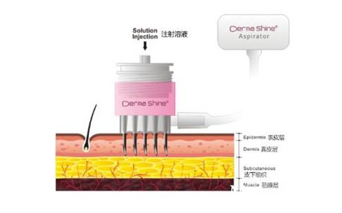 �ɼ�ˮ���ԭ��