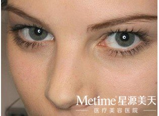 ���۽Ƕ೤ʱ��ָ�