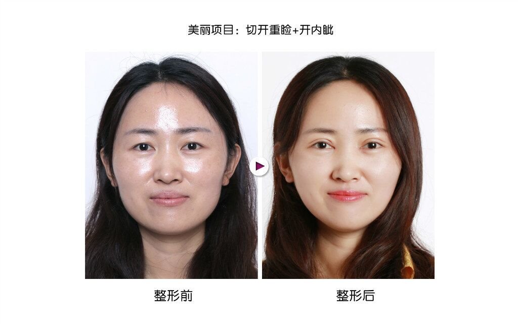 ��˫��Ƥ�����ļҺ�