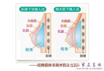 ����¡��