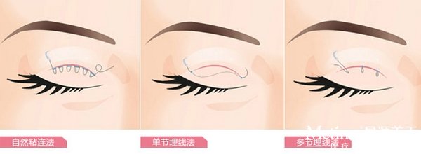 ������˫��Ƥ����Ǯ