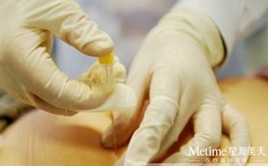 中医埋线减肥哪些因素会影响价格