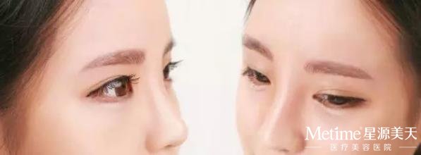 纹眉后几天可以洗脸