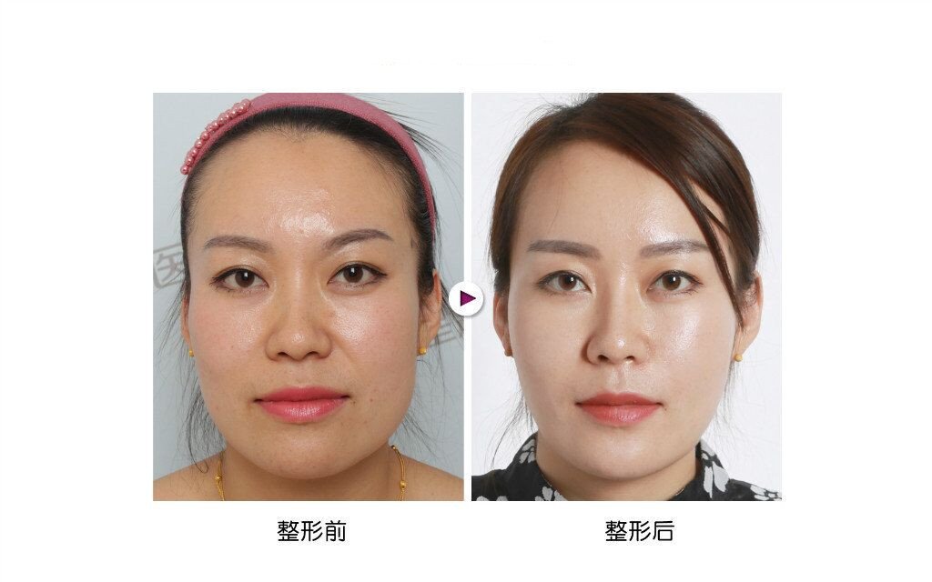 淘宝涂抹式水光针靠谱吗