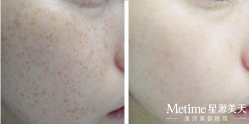 ������߰�ȫ��