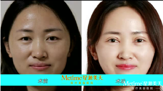 ѧ���ʺ�������˫��Ƥ