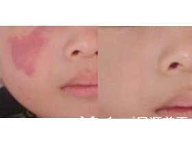 ����ȥ̥��Ч������