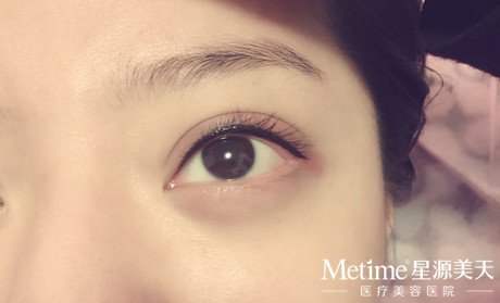 ��ʽ��������ͫ��