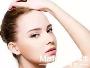 激光去雀斑注意事项很全面