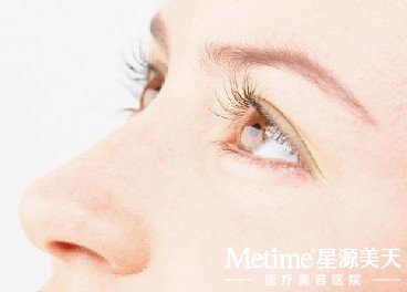 注射祛眉间纹价格不是固定的