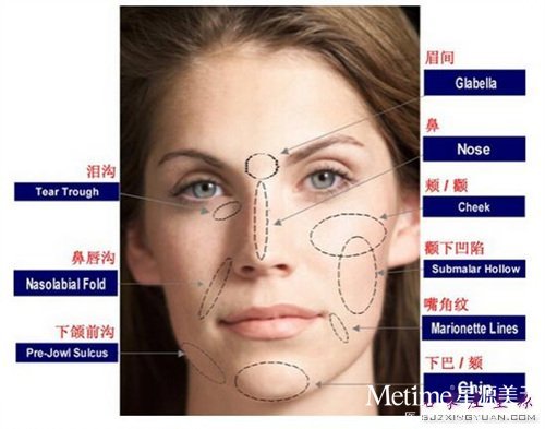 �沿��䲿λ ʾ��ͼ