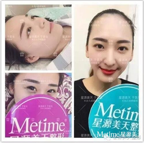 韩式半永久纹唇和漂唇的区别