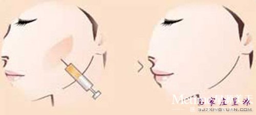 ����֬����ƻ���� ��ȫ������