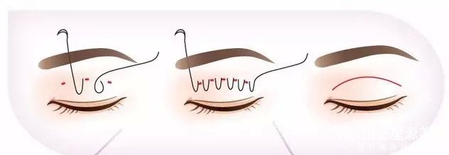 ������˫��Ƥ���Ż���