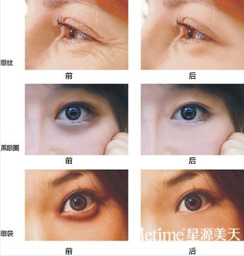 35���۽����ƺ�������ô��