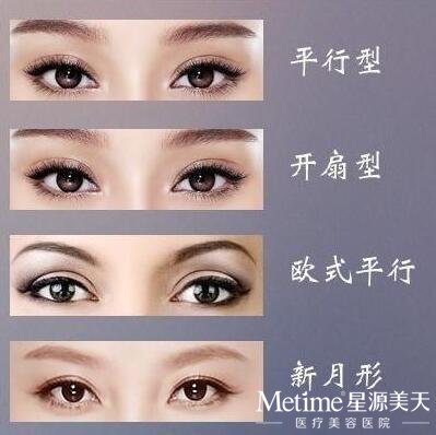 你的脸型适合哪种双眼皮