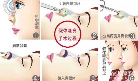 �轺����¡�ǻ��ƶ��������