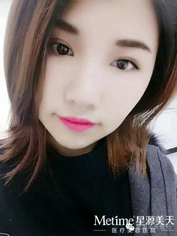 网红妹子为瘦脸针疯狂