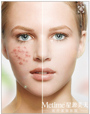 ��������Ӱ��Ƥ����