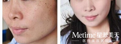  �������Ч�����