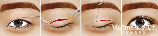 ��ô��˫��Ƥ����ȫ