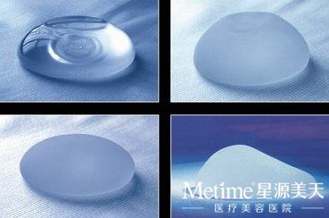 胸部整形假体的寿命究竟多长