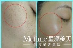 ������ȸ��˵�ټ�