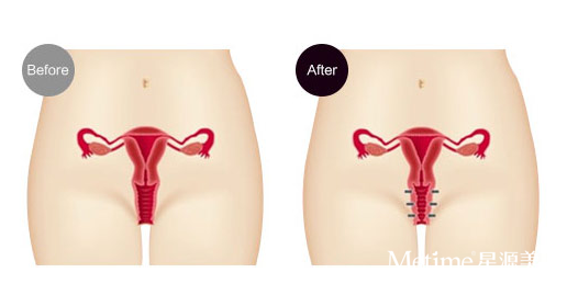 ������˽�ܼ������⼯��